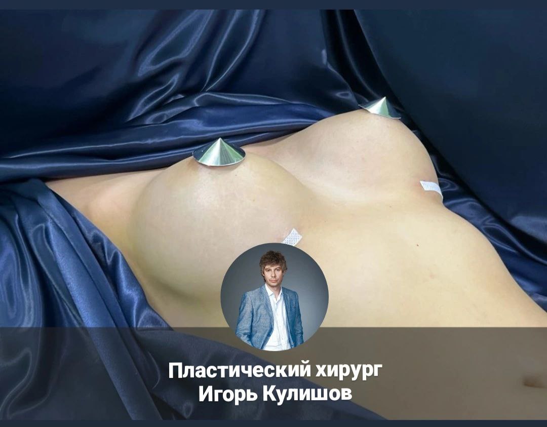 маммопластика-кулишов