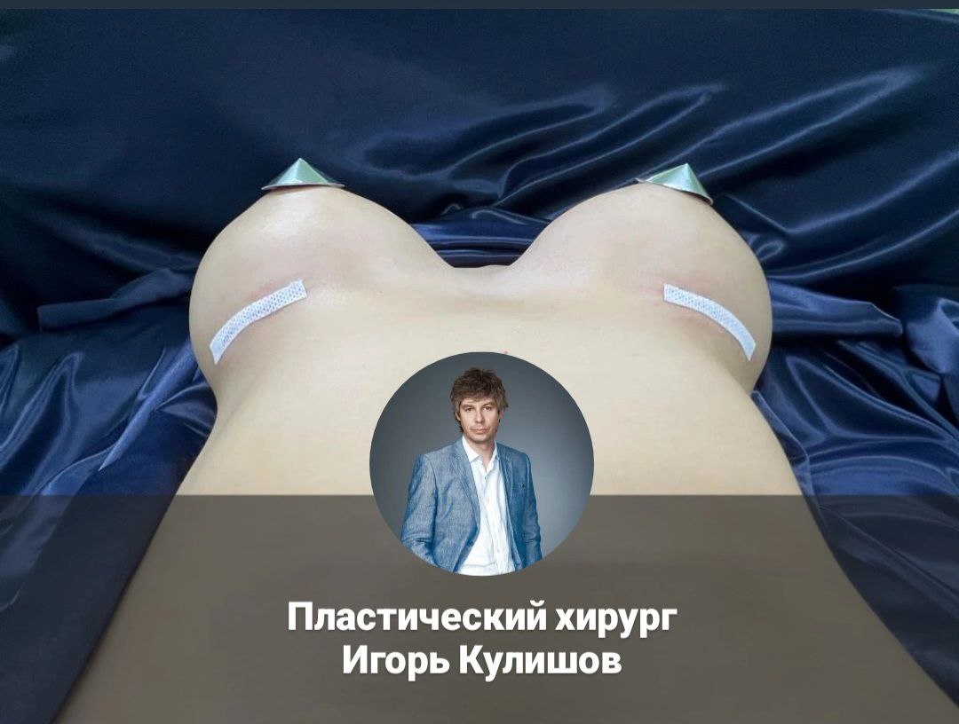 маммопластика-кулишов