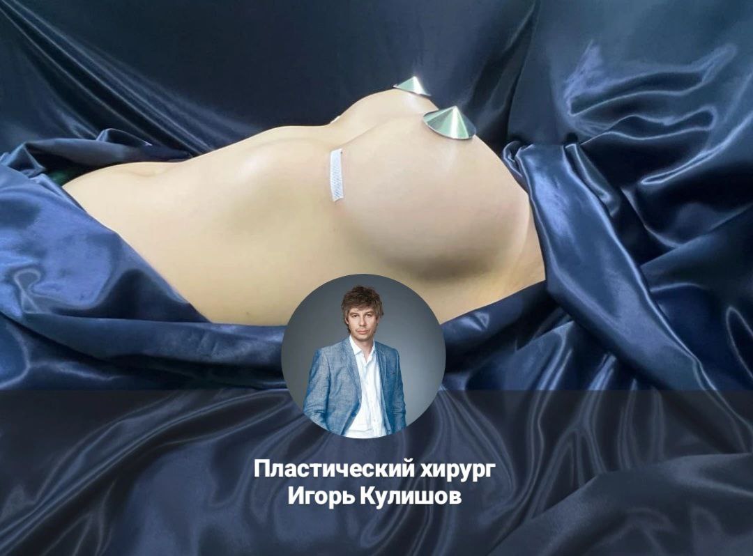маммопластика-кулишов